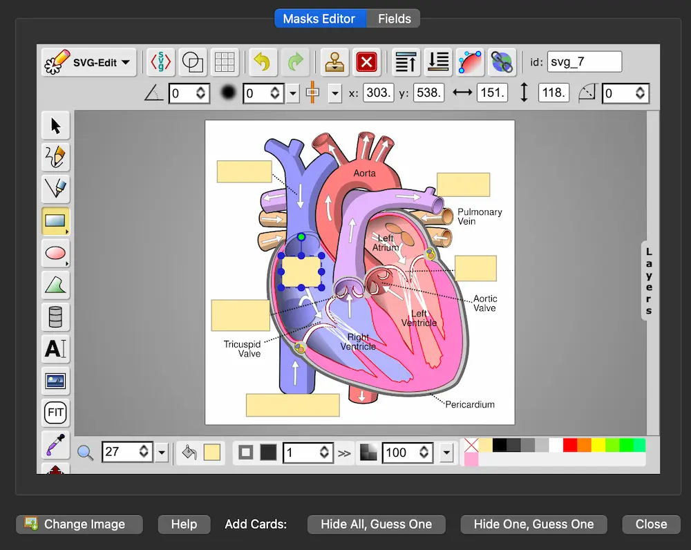AnkiのImage Occlusionエディタで心臓の解剖図にマスク（目隠し）を作成している画面